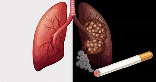 Tại sao thuốc lá gây ung thư phổi?- Bật mí bí kíp giúp bỏ thuốc lá cực nhanh